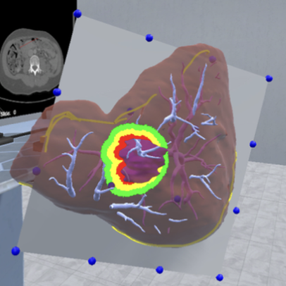 Virtual Resection Planning using Bezier Surface Interactions in Collaborative VR Environments