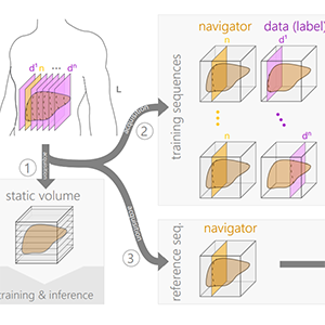 Transfer-learning is a key ingredient to fast deep learning-based 4D liver MRI reconstruction