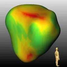 Automatic high resolution segmentation of the prostate from multi-planar MRI