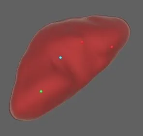 Entwicklung eines Registrierungskonzepts für laparoskopische Augmented Reality